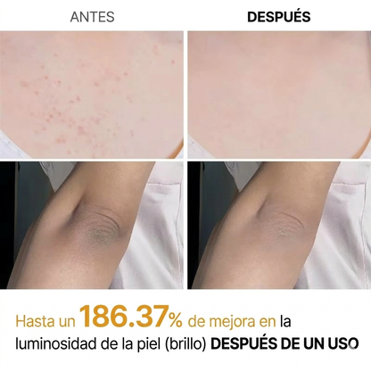 Dr. Melaxin Peel Shot — Spray Coreano para Manchas, Codos Oscuros y Piel Opaca
